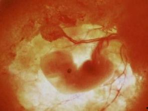 受孕过程视频高清